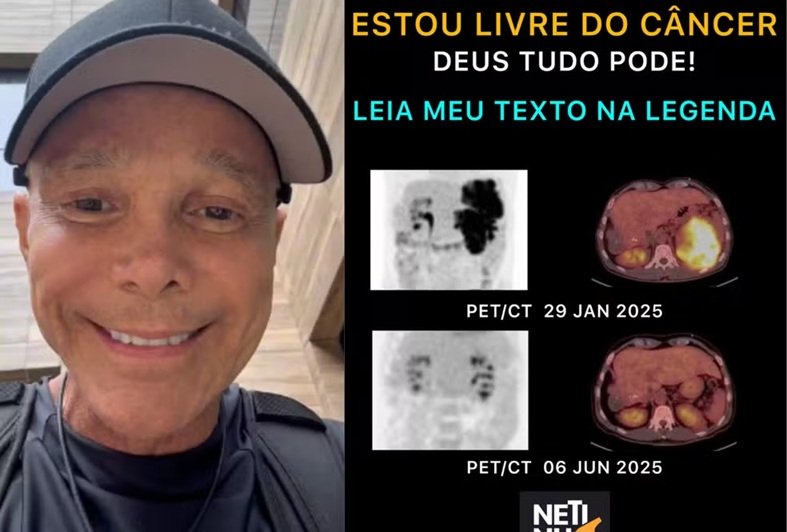 Cantor Netinho