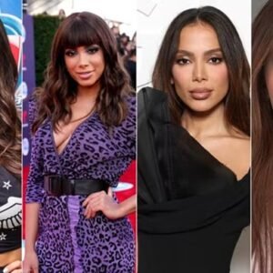 Mudança radical de anitta acende debate: há limites para ‘comprar’ um novo rosto?