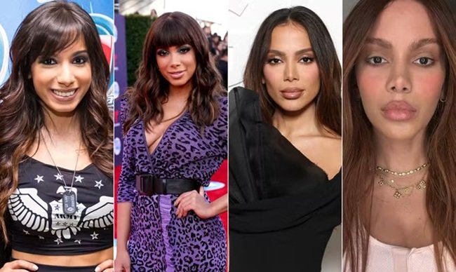 Mudança radical de anitta acende debate: há limites para ‘comprar’ um novo rosto?