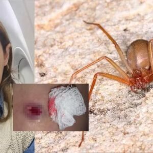 Dentista é picada por aranha-marrom