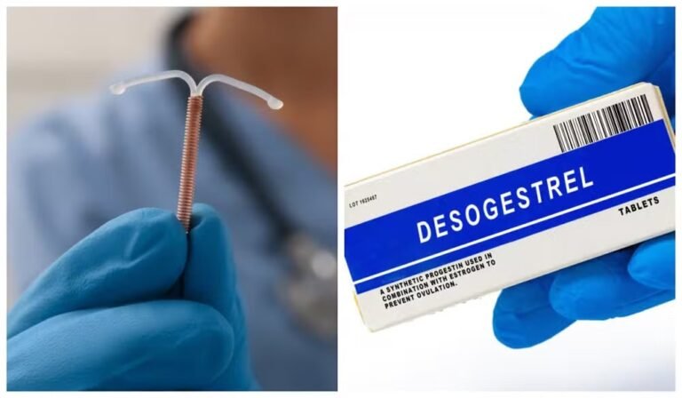 Utensílios