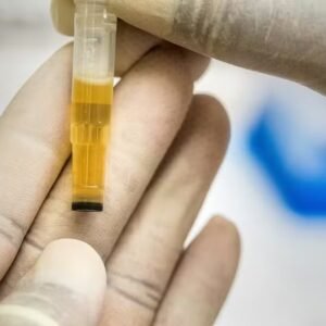 Cientistas criam novo material para implantes dentários usando… xixi