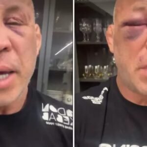 ‘Dois dias e o olho ainda não abriu’, diz Wanderlei Silva