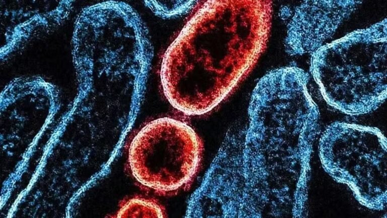 Virus