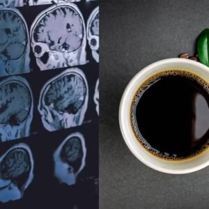 Café pode reduzir a chance de demência, diz estudo