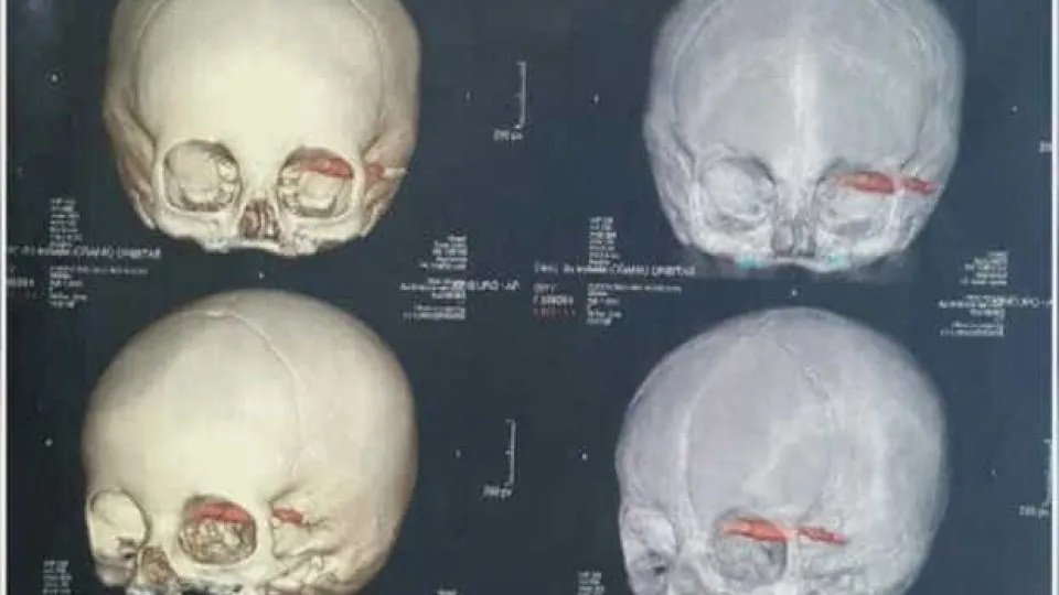 Cientistas acham crânios de 2.000 anos, e detalhe nos dentes chama atenção