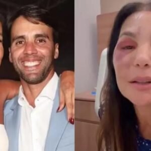 Ex-marido de Ivete fala sobre a cirurgia da cantora: ‘Mulher de aço’