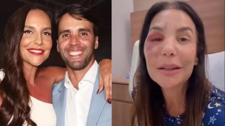 Ex de Ivete