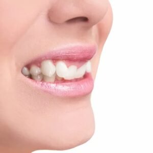 Sorriso desalinhado? Vejas 6 problemas que vão além da saúde bucal