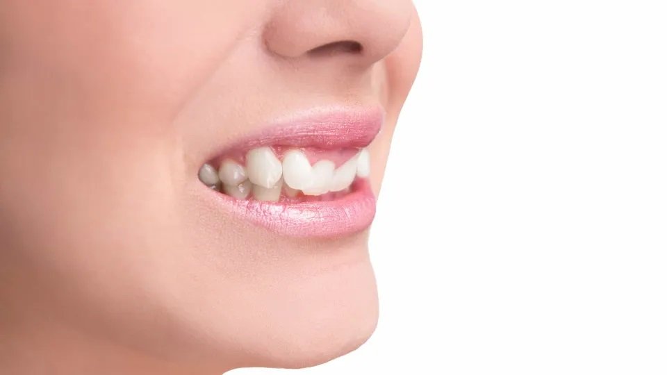 Sorriso desalinhado? Vejas 6 problemas que vão além da saúde bucal
