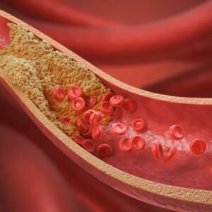10 alimentos que cardiologistas indicam para baixar o colesterol