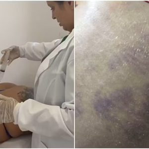 Falsa médica presa em João Pessoa pode responder por pelo menos quatro crimes, afirma delegado
