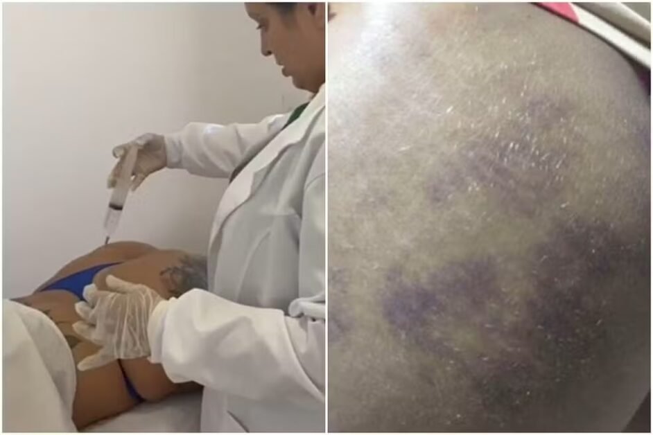 Falsa médica presa em João Pessoa pode responder por pelo menos quatro crimes, afirma delegado