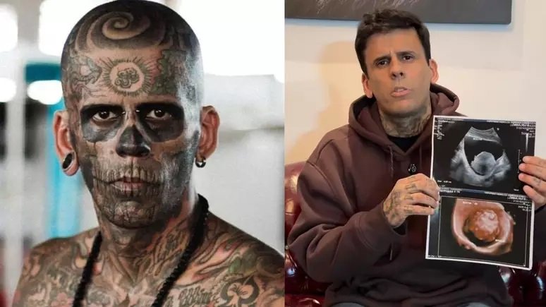 Após diagnóstico de insuficiência renal, ‘homem mais tatuado do Brasil’ descobre tumor na bexiga