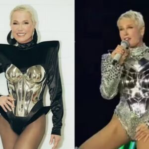 Xuxa conta o que aconteceu de verdade no episódio da virilha