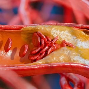 5 alimentos ricos em proteína que também têm muita gordura; veja quais