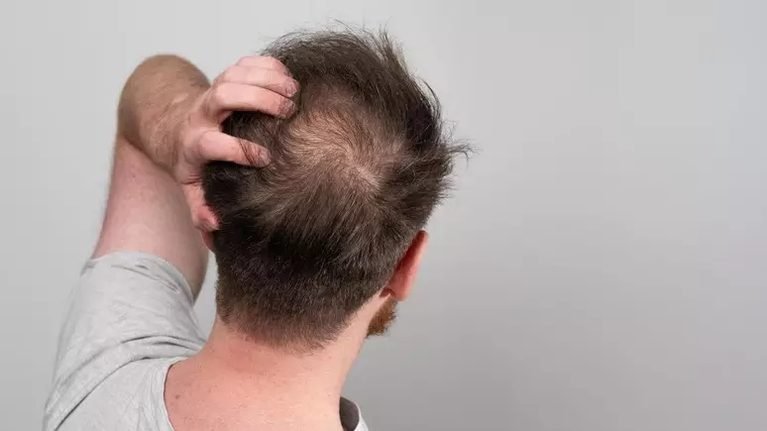 Cabelo