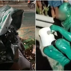 Morre vereador que causou acidente de trânsito que ‘deixou homem verde’