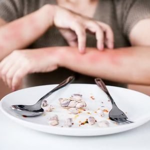 Quando uma alergia pode ser fatal: reações graves mataram quase 500 pessoas no Brasil desde 2022